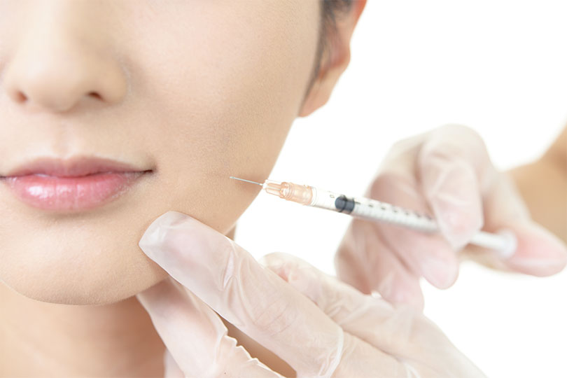 ヒアルロン酸注入