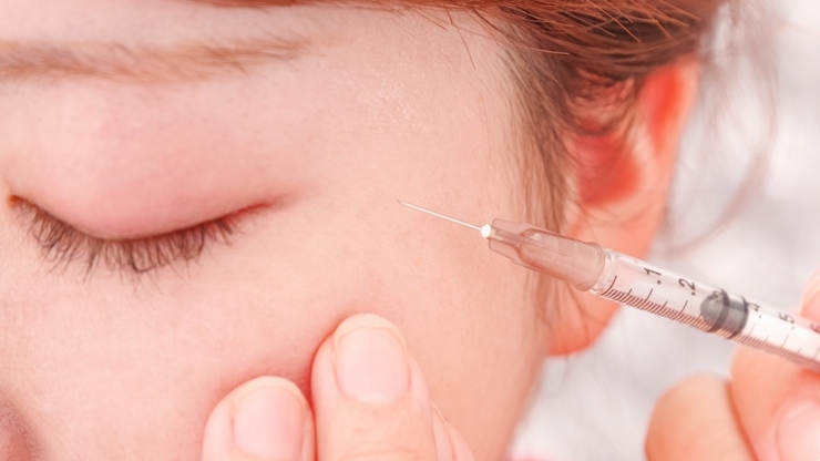 ヒアルロン酸注入